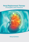 Renal Replacement Therapy: Principles and Practice - Hardcover
