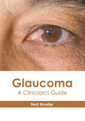 Glaucoma: A Clinician's Guide - Hardcover