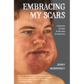 Embracing My Scars: A journey of hope in the face of adversity - Paperback