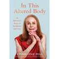 In This Altered Body: A Survivor's Story of Resilience and Love - Hardcover