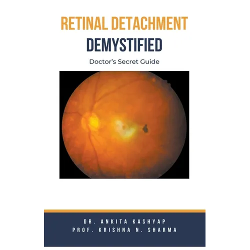 Retinal Detachment Demystified: Doctor's Secret Guide - Paperback