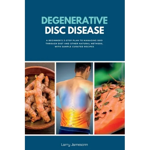 Degenerative Disc Disease: A Beginner's 3-Step Plan to Managing DDD Through Diet and Other Natural Methods, with Sample Curated Recipes - Paperback
