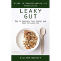 Leaky Gut: Guide to Understanding the Protection (How to Increase Your Energy and Cure Inflammation): Guide to Understanding the - Paperback